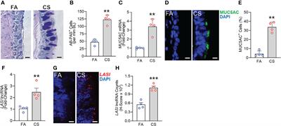 Increased Expression of LASI lncRNA Regulates the Cigarette Smoke and COPD Associated Airway Inflammation and Mucous Cell Hyperplasia